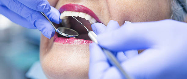 Best Cracked Tooth Emergency Dentist  in North River Shores, FL